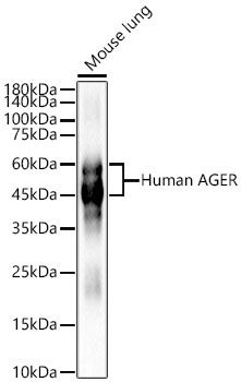 Human AGER Rabbit Polyclonal Antibody