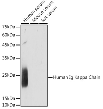 Human Ig Kappa Chain Rabbit Monoclonal Antibody