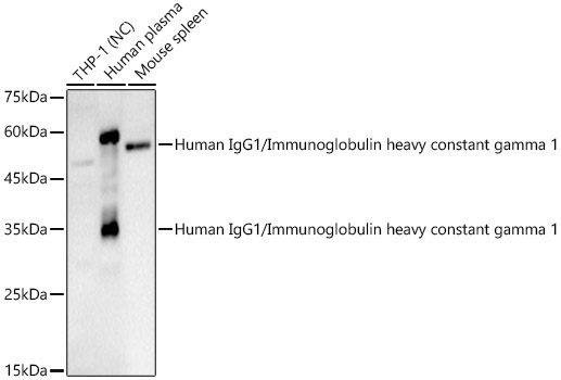 Human IgG1/Immunoglobulin heavy constant gamma 1 Rabbit Polyclonal Antibody