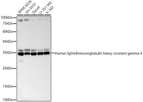 Human IgG4/Immunoglobulin heavy constant gamma 4 Rabbit Polyclonal Antibody