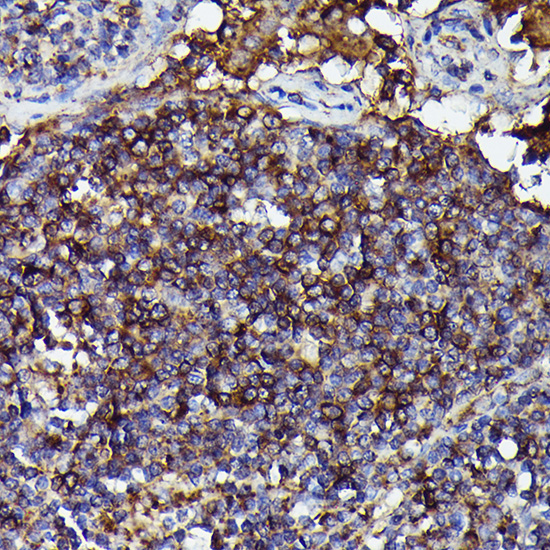 Human IgM Rabbit Monoclonal Antibody - Image 2