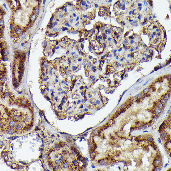 Human IgM Rabbit Monoclonal Antibody - Image 3