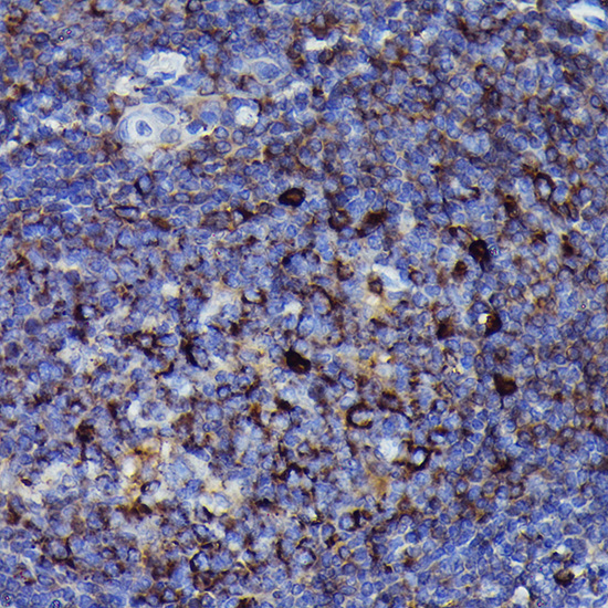 Human IgM Rabbit Monoclonal Antibody - Image 4