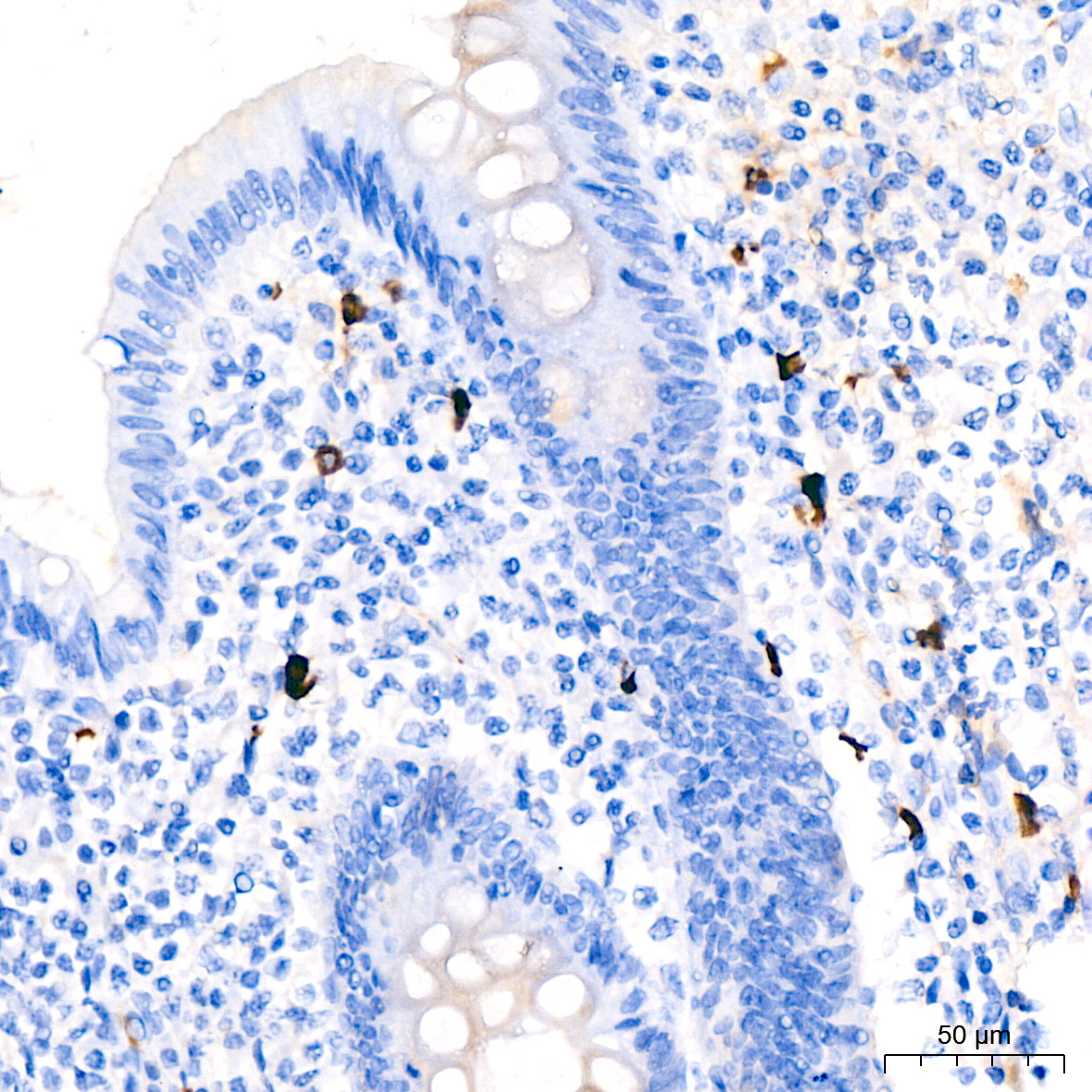 Human IgM Rabbit Monoclonal Antibody - Image 2