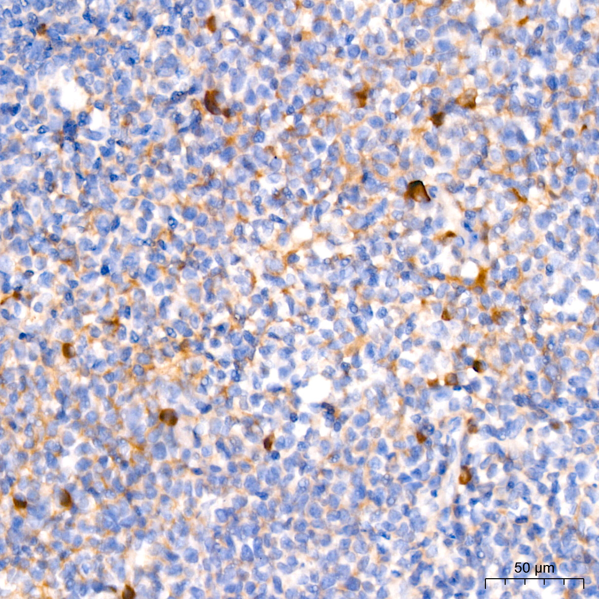 Human IgM Rabbit Monoclonal Antibody - Image 3