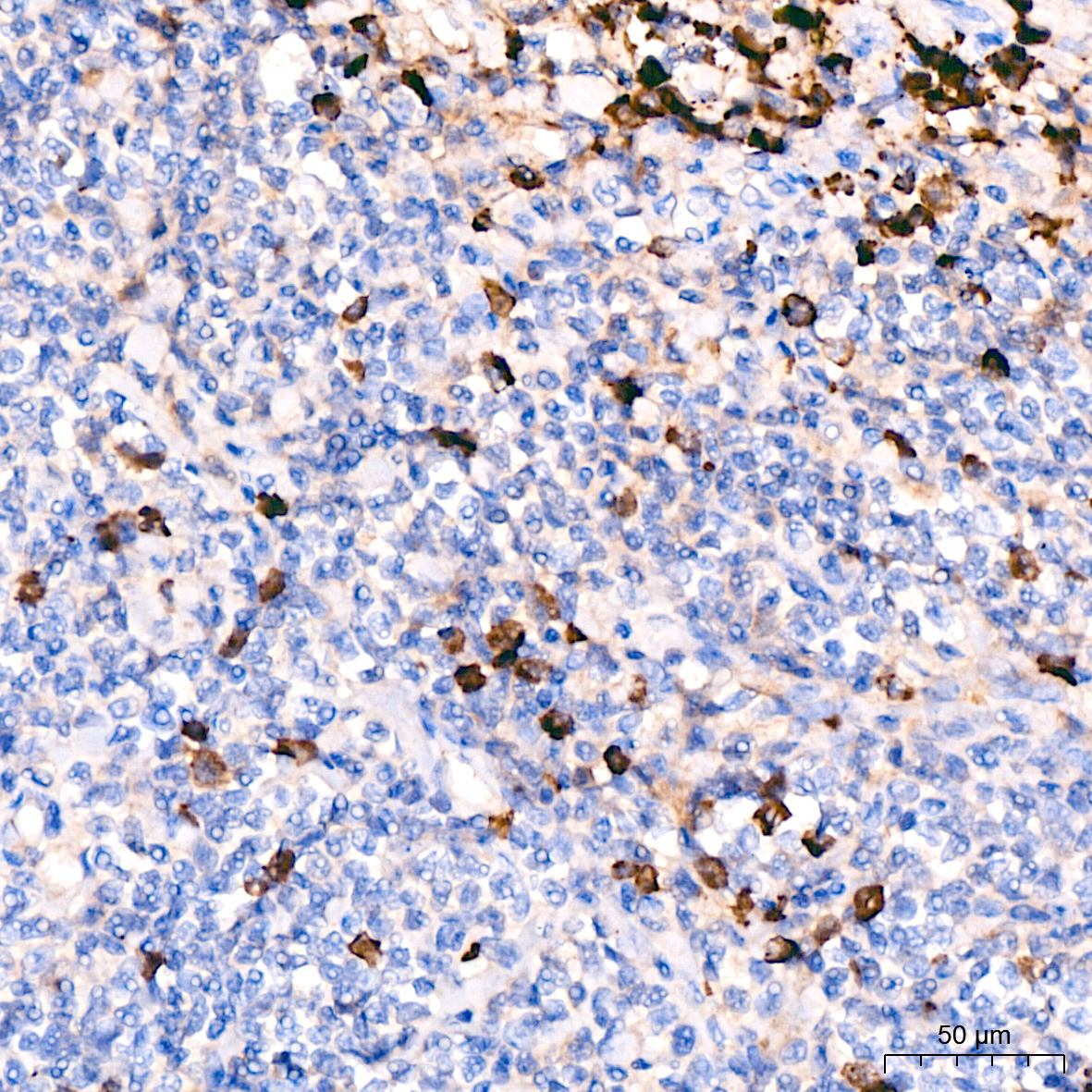 Human IgM Rabbit Monoclonal Antibody - Image 4