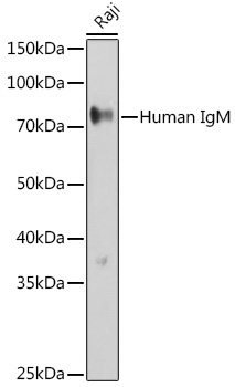 Human IgM Rabbit Polyclonal Antibody
