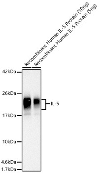 Human IL-5 Rabbit Polyclonal Antibody