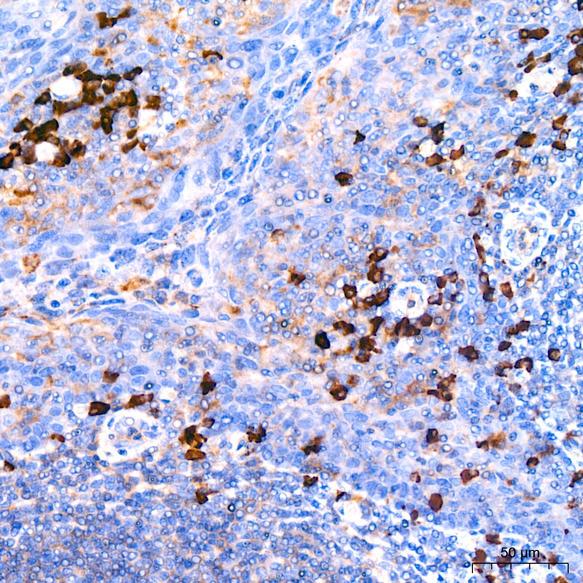 Human Lambda Light Chain Rabbit Monoclonal Antibody - Image 2