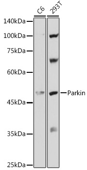 Human Parkin Rabbit Polyclonal Antibody
