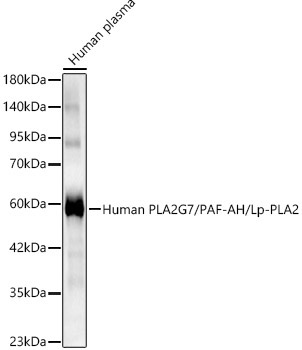 Human PLA2G7/PAF-AH/Lp-PLA2 Rabbit Polyclonal Antibody