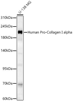 Human Pro-Collagen I alpha Rabbit Polyclonal Antibody