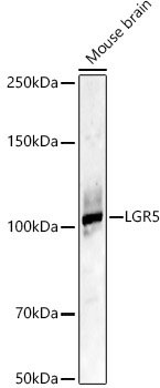 LGR5 Rabbit Polyclonal Antibody