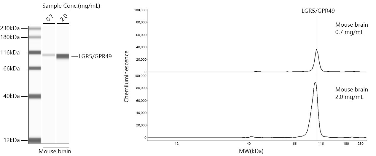LGR5/GPR49 Rabbit Monoclonal Antibody