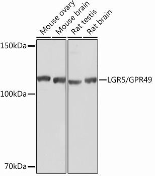 LGR5/GPR49 Rabbit Monoclonal Antibody - Image 2
