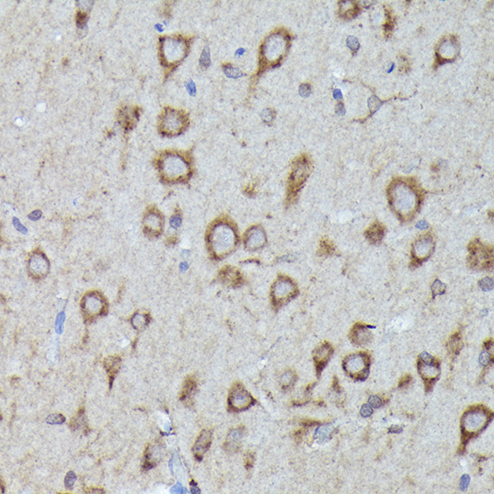 LGR5/GPR49 Rabbit Polyclonal Antibody - Image 2