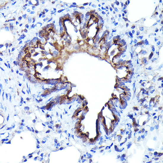 LGR5/GPR49 Rabbit Polyclonal Antibody - Image 3