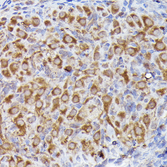 LGR5/GPR49 Rabbit Polyclonal Antibody - Image 4