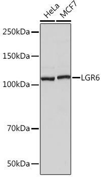 LGR6 Rabbit Monoclonal Antibody