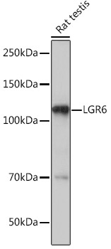 LGR6 Rabbit Monoclonal Antibody - Image 2