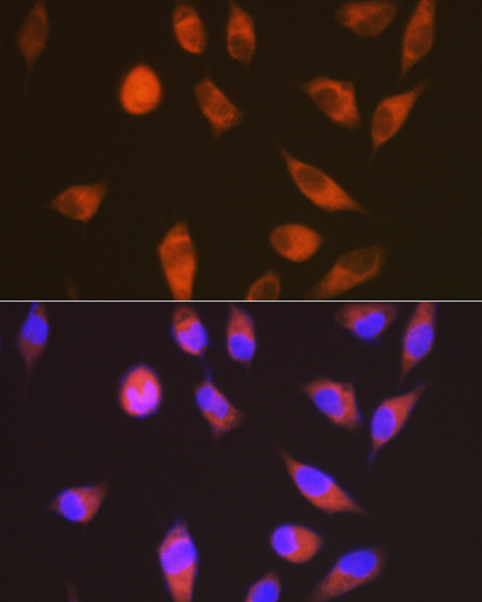 LGR6 Rabbit Monoclonal Antibody - Image 3