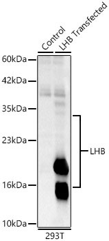 LHB/CGB1 Rabbit Polyclonal Antibody