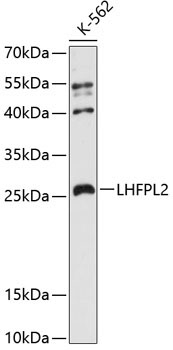 LHFPL2 Rabbit Polyclonal Antibody