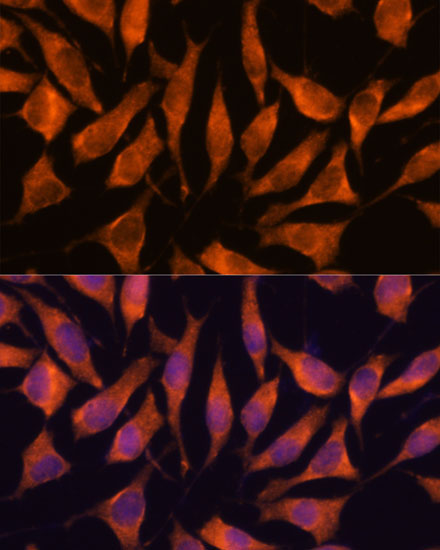 LHPP Rabbit Polyclonal Antibody - Image 2