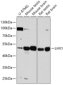 LHX1 Rabbit Polyclonal Antibody