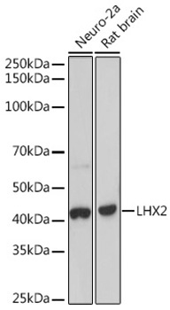 LHX2 Rabbit Monoclonal Antibody