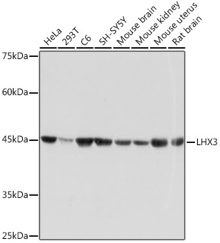 LHX3 Rabbit Monoclonal Antibody