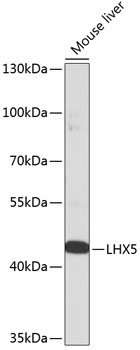LHX5 Rabbit Polyclonal Antibody