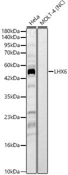 LHX6 Rabbit Polyclonal Antibody