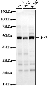 LHX6 Rabbit Polyclonal Antibody