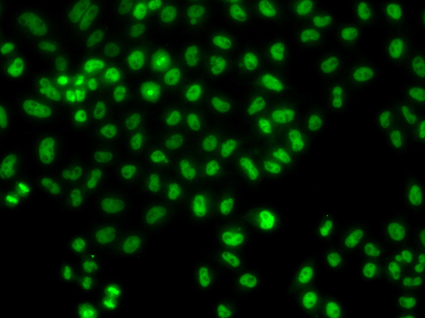 LHX8 Rabbit Polyclonal Antibody