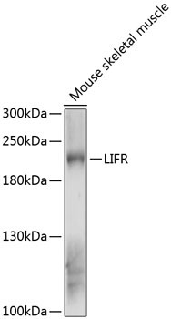 LIFR Rabbit Polyclonal Antibody