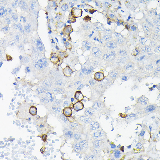 LILRB4 Rabbit Polyclonal Antibody - Image 3
