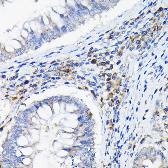 LILRB4 Rabbit Polyclonal Antibody - Image 4