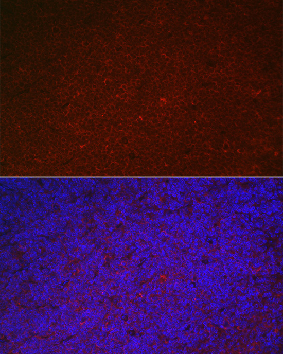 LILRB4 Rabbit Polyclonal Antibody - Image 5
