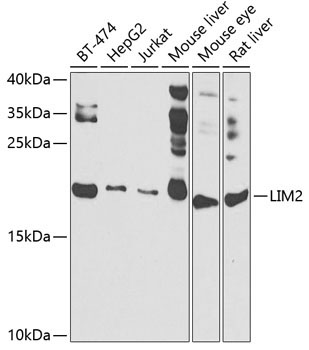 LIM2 Rabbit Polyclonal Antibody