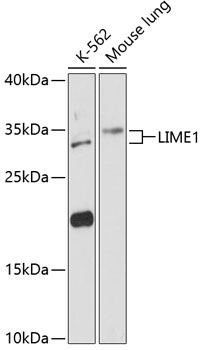 LIME1 Rabbit Polyclonal Antibody