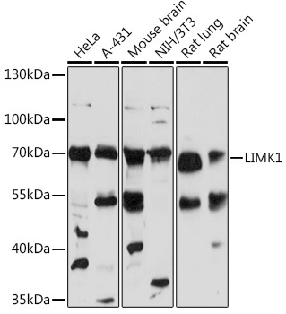LIMK1 Rabbit Polyclonal Antibody