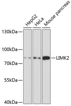 LIMK2 Rabbit Polyclonal Antibody