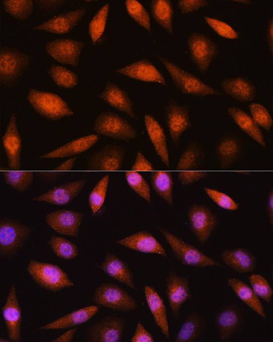 LIMK2 Rabbit Polyclonal Antibody - Image 2