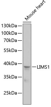 LIMS1 Rabbit Polyclonal Antibody