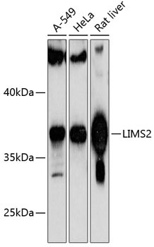 LIMS2 Rabbit Polyclonal Antibody