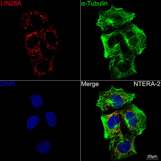 LIN28A Rabbit Monoclonal Antibody - Image 2