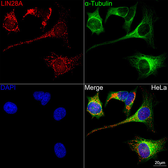 LIN28A Rabbit Monoclonal Antibody - Image 3