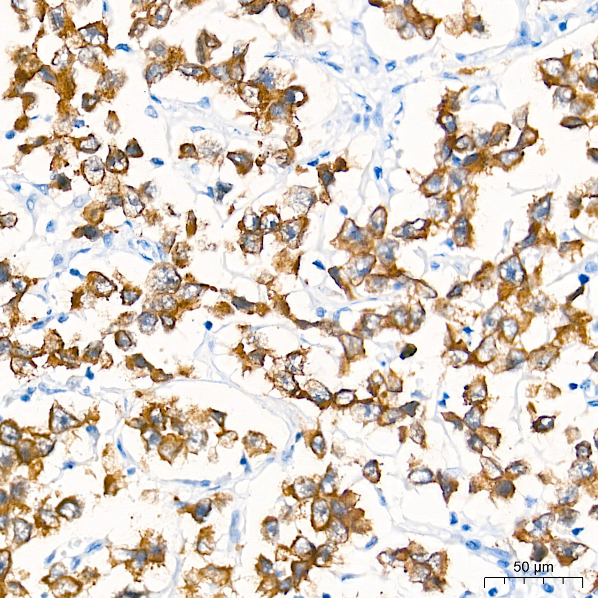 LIN28B Rabbit Monoclonal Antibody - Image 2