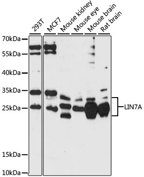 LIN7A Rabbit Polyclonal Antibody